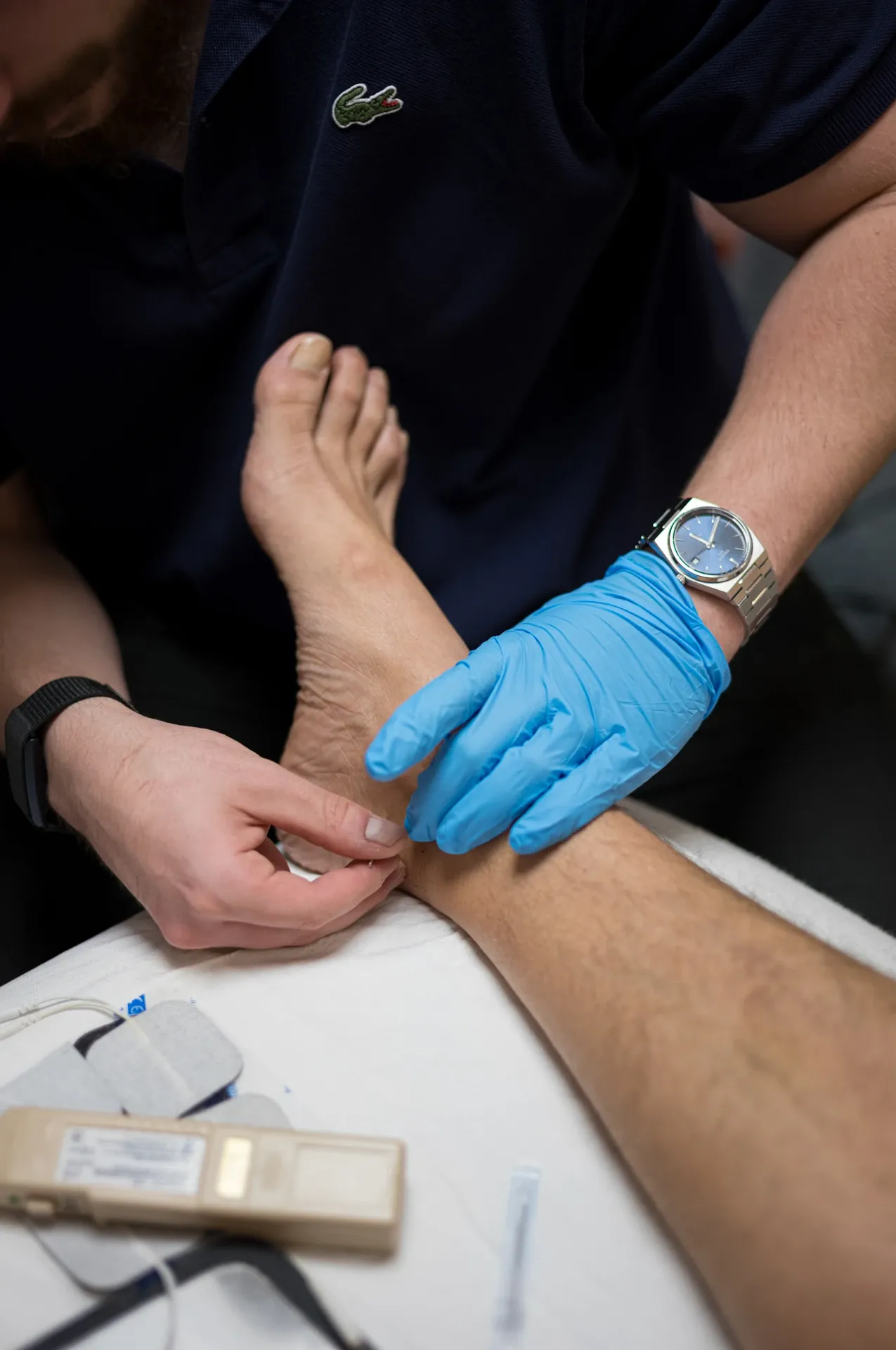 Punción seca con aguja en el pie, en la clínica de Iñigo Goikoetxea, fisioterapeuta en Bilbao